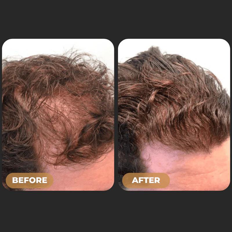 SPARTAN™ Root Activator Shampoo For Men Hair Loss